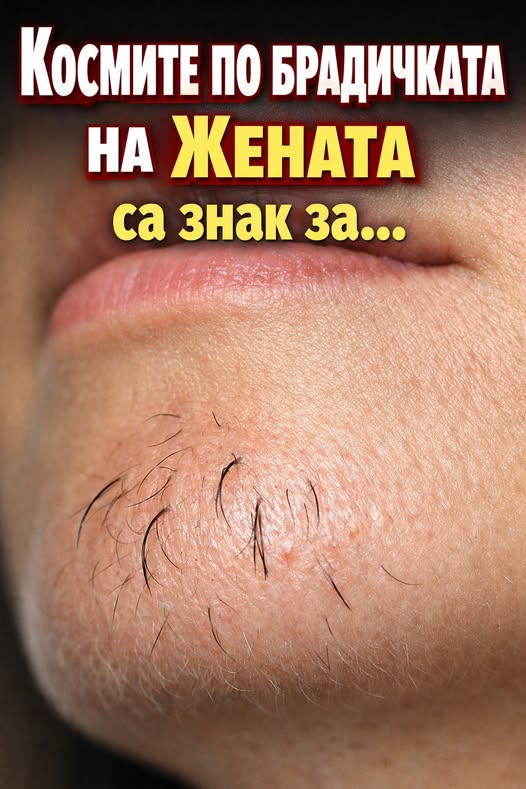 Космите по брадичката на жената са знак за...Вижте повече 👇 3 632511569 122183637074593989 3909774436517053025 n