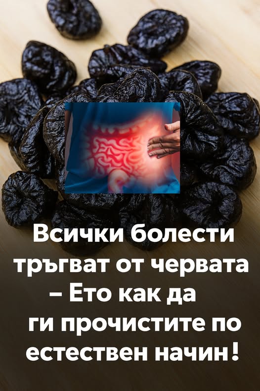 Всички болести тръгват от червата – ето как да ги прочистите по естествен начин! 3 633581380 1342181271282489 5488840270290117627 n