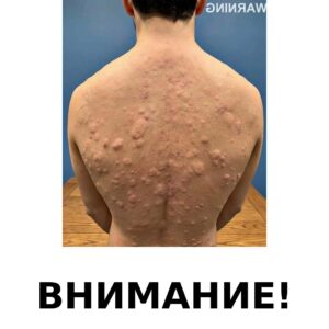Ето до какво може да доведе, когато спиш с… Научи повече 👇 8 image with banner attention