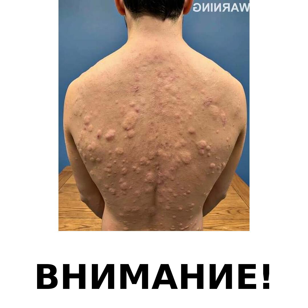 Ето до какво може да доведе, когато спиш с… Научи повече 👇 3 image with banner attention