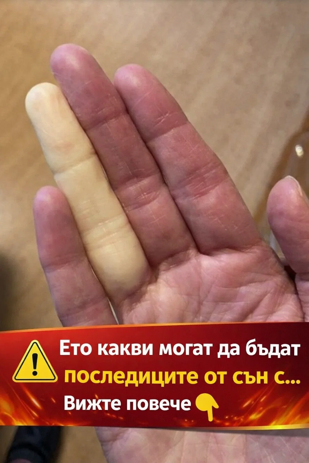 Ето какви могат да бъдат последиците от сън с… Вижте повече 👇 3
