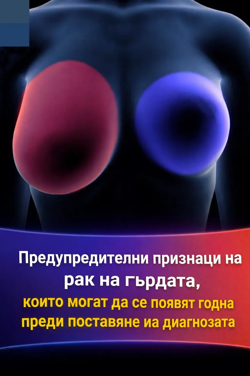 Рак на гърдата: 4 ранни признака, които всяка жена трябва да познава 3