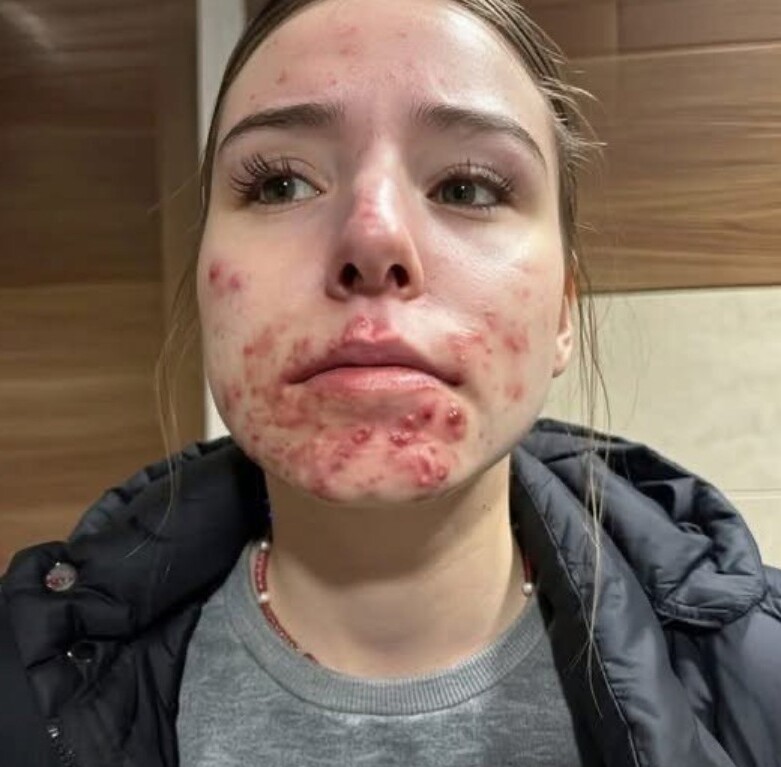 Това са последиците от съня с… Вижте повече👇 3 621458049 898372326102248 785916