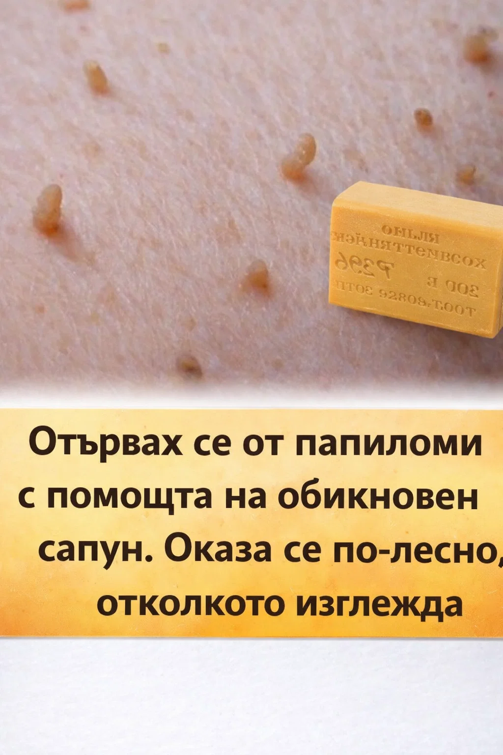 Успях да се справя с папиломите, използвайки обикновен сапун. Оказа се далеч по-лесно, отколкото си представях. 3 task 01kdqwcrd7ft8sh73p3erav00v 1767106898 img 1