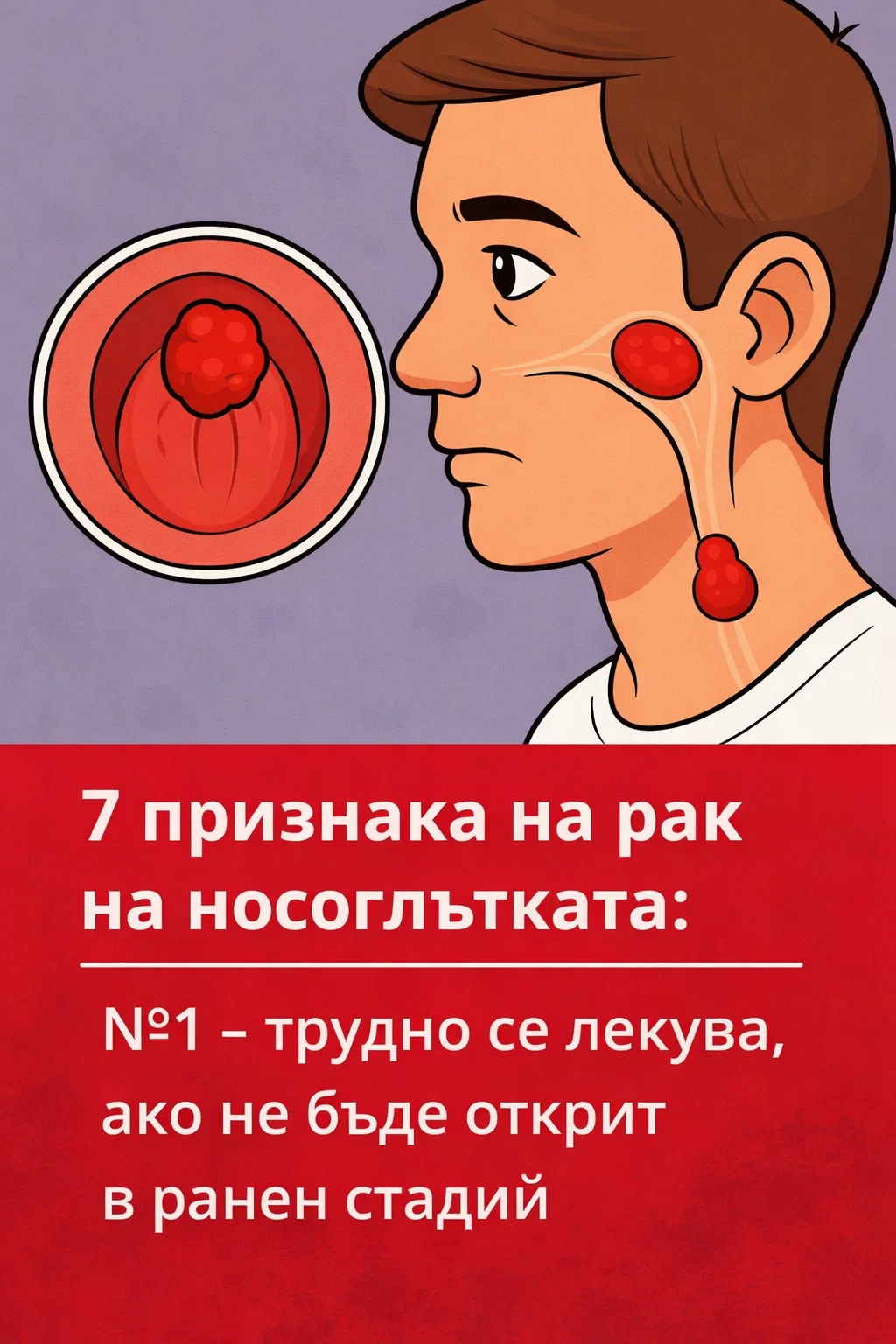 Бъдете нащрек! Има 7 признака, които могат да насочат към рак на носоглътката – първият е особено рисков при късно установяване 👇 5