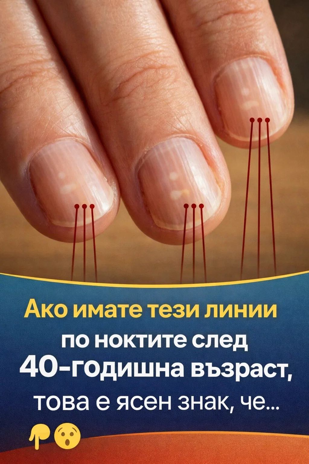 Ако забелязвате такива вертикални линии по ноктите си след 40-годишна възраст, това може да е ясен сигнал за… вижте повече 👀👇 3