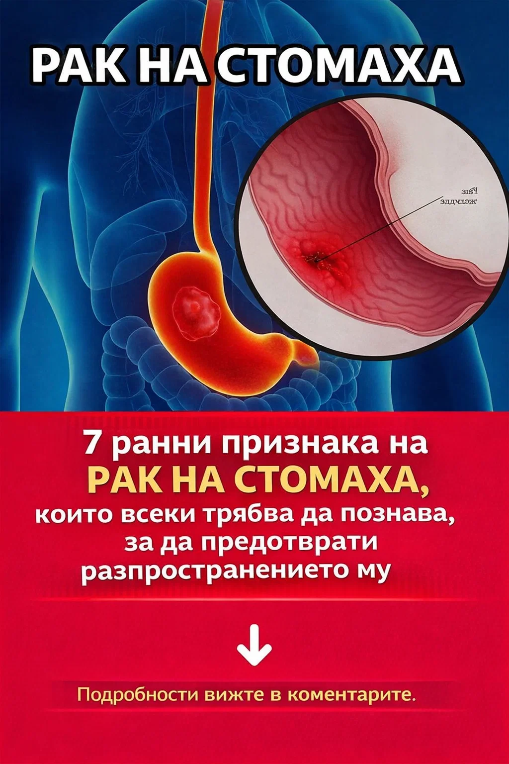 7 ранни признака на рак на стомаха, които всеки трябва да познава, за да предотврати разпространението му 5 task 01kf8f2s3gf2hs3927z3j76cpc 1768737128 img 0