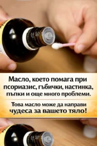 Масло, за което се твърди, че помага при псориазис, гъбички, настинка, пъпки и още редица проблеми. Това масло може да бъде много полезно за вашето тяло! 20 task 01kk16rmybebsaxjs9sakqs1hm 1772788475 img 1