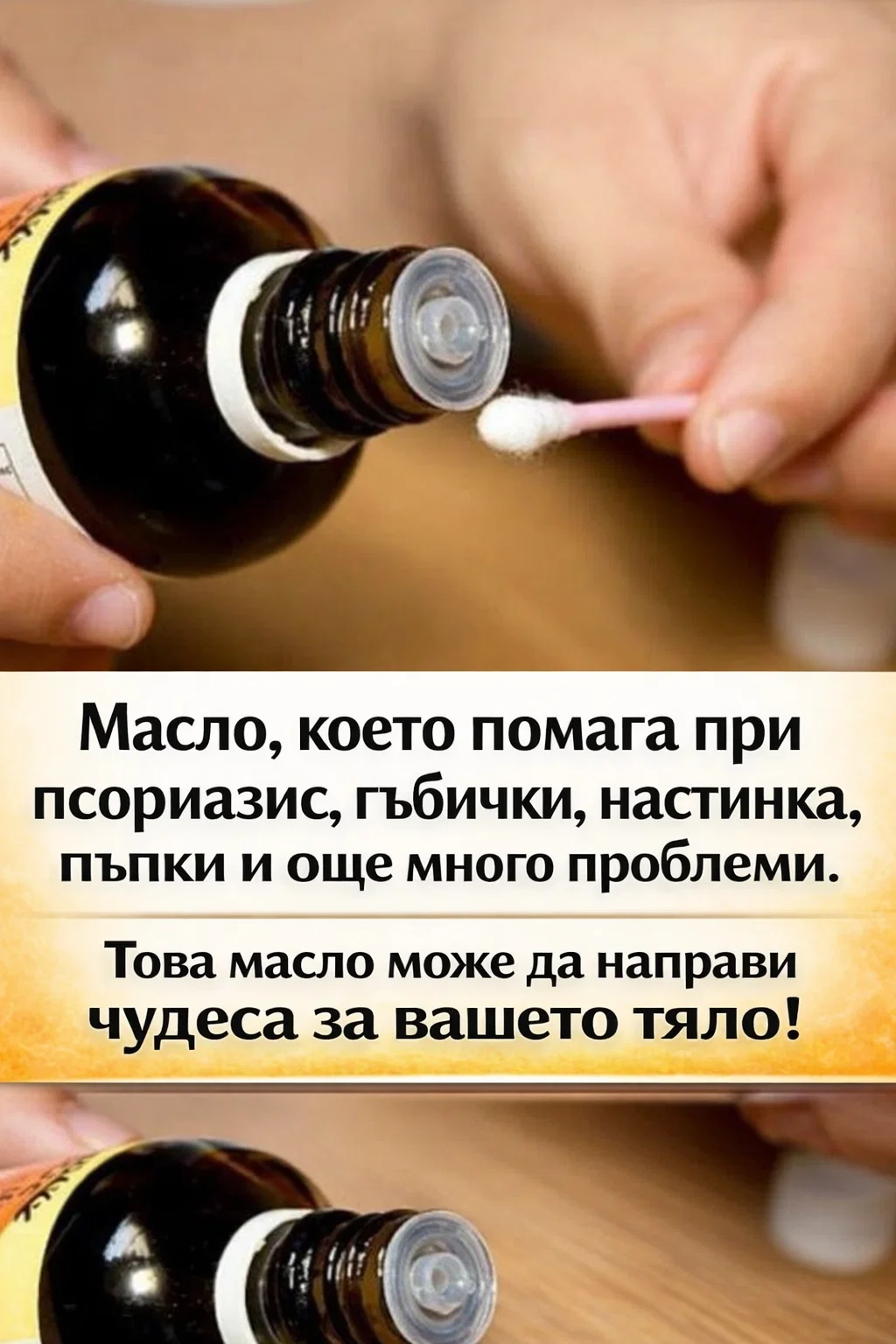 Масло, за което се твърди, че помага при псориазис, гъбички, настинка, пъпки и още редица проблеми. Това масло може да бъде много полезно за вашето тяло! 3
