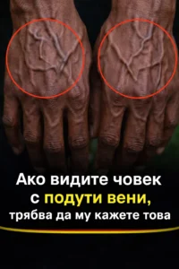Ако вените ти се виждат ясно, това означава, че… Виж повече 👇 30 task 01kmfrgrsne6rbhybks04vgrbt 1774350555 img 1