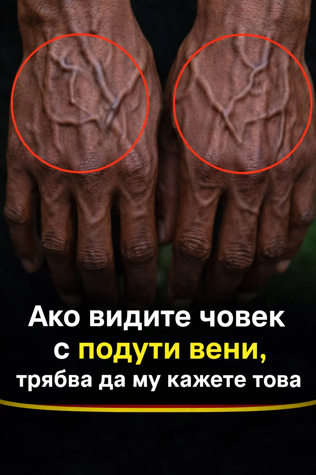 Ако вените ти се виждат ясно, това означава, че… Виж повече 👇 3 task 01kmfrgrsne6rbhybks04vgrbt 1774350555 img 1