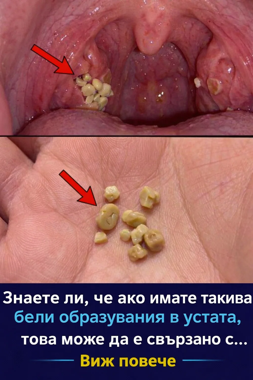 Знаете ли, че появата на такива бели образувания в устата може да бъде свързана с… 👇👇 Виж повече 3 task 01kn1vvcabej1agpj4bzybb9m8 1774958034 img 0