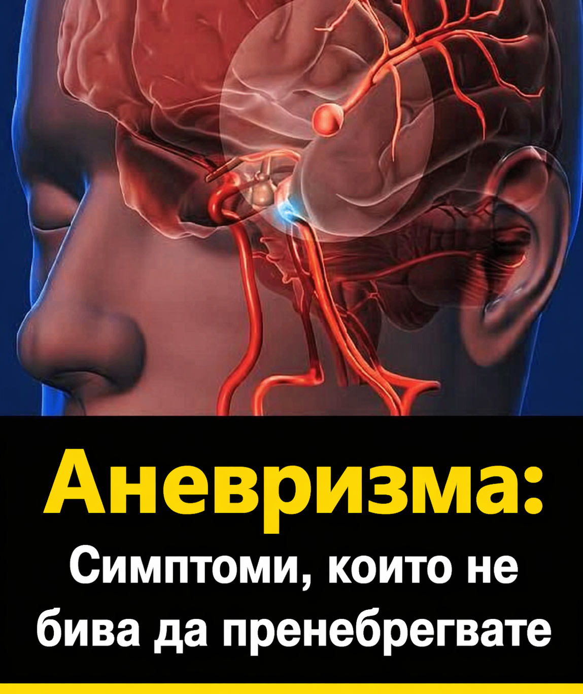 Аневризма: Признаци, които не бива да пренебрегвате… Вижте повече 3 chatgpt image 24.04.2026 g. 10 07 22