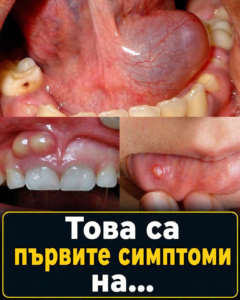 Това са първите симптоми на… 👇👇👇 112 chatgpt image 24.04.2026 g. 12 08 49
