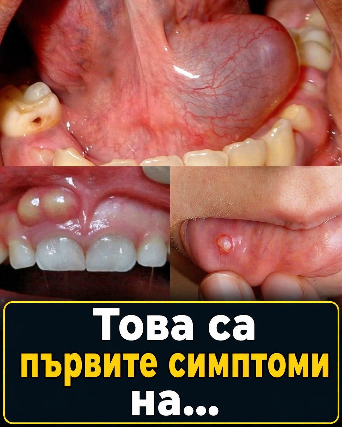 Това са първите симптоми на… 👇👇👇 3 chatgpt image 24.04.2026 g. 12 08 49