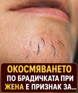 Окосмяването по брадичката при жените може да е знак за… Вижте повече 👇 8 chatgpt image 27.04.2026 g. 10 06 56