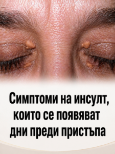 Симптоми на инсулт, които се появяват дни преди пристъпа 👇👇👇 44 chatgpt image 29.04.2026 g. 12 18 40