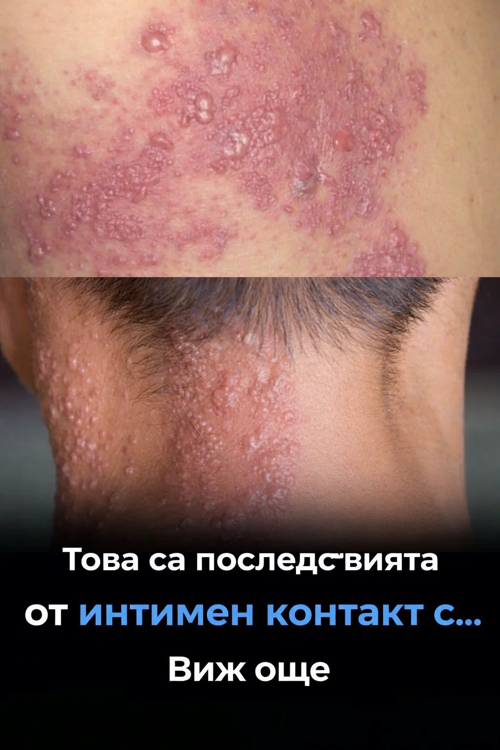 Това са последствията от интимна връзка с… Виж още 👇 3