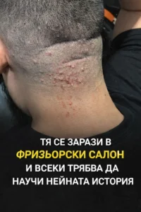 Той си мислеше, че е просто леко раздразнение… Виж повече в първия коментар 👇 20 task 01knkmxz4jeabtx5wpkfadyrb0 1775554762 img 1