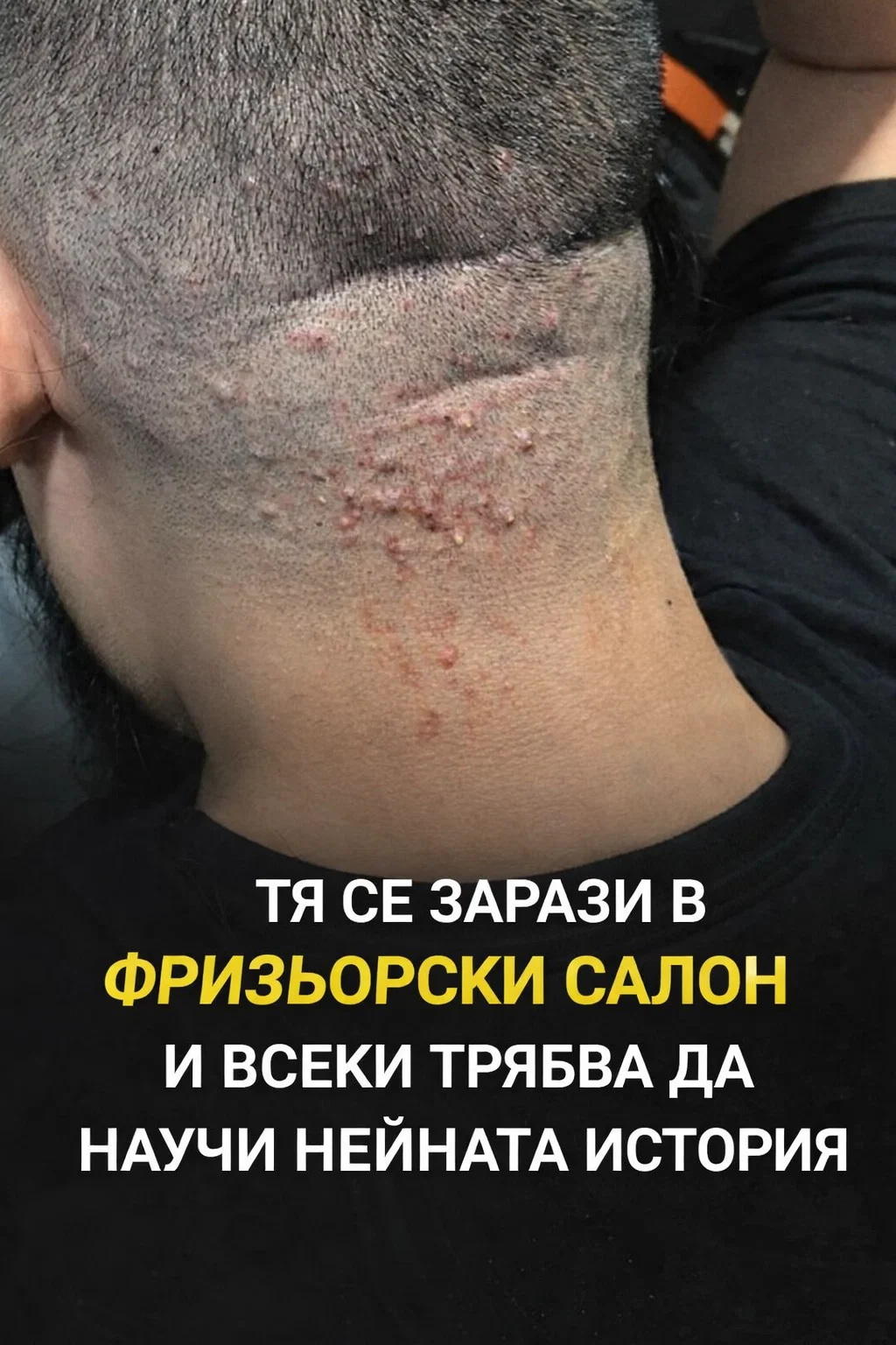 Той си мислеше, че е просто леко раздразнение… Виж повече в първия коментар 👇 3