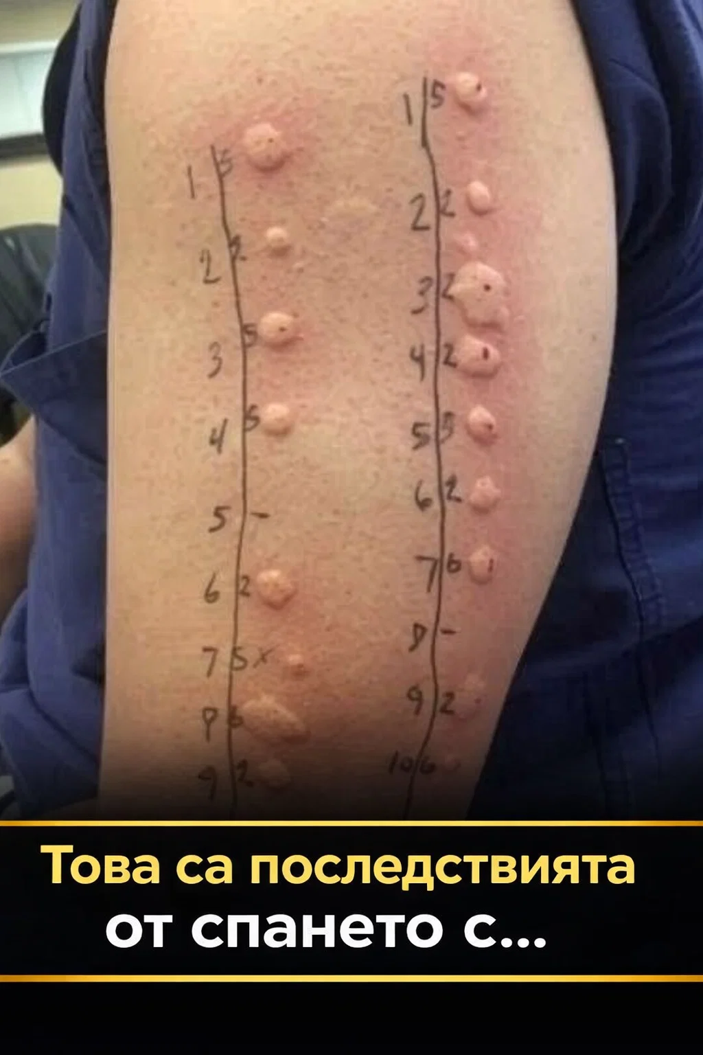 Ето какви могат да бъдат последствията от спането с… Вижте още 3 task 01knrns0j5ftgabtsm8ep5kafr 1775723465 img 1