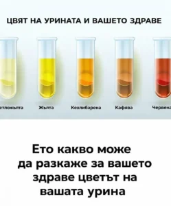 Разберете как цветът на урината може да отразява състоянието на организма. 14 task 01kpbqd1stfkz93f6wcx4xhp4y