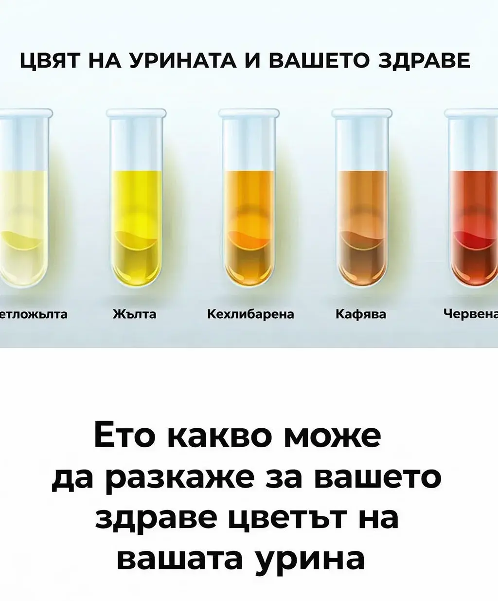 Разберете как цветът на урината може да отразява състоянието на организма. 3