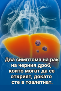 Два признака на рак на черния дроб, които могат да се забележат в банята 2 20250818 1421 simptomi na rak na cherniya drob remix 01k2yeg40zfssar97p36m7bwyj