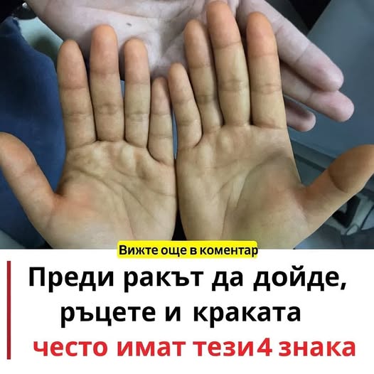 Преди ракът да дойде ,ръцете и краката имат тези симптоми 👇 3 528394400 775659694807265 8518885290048229325 n
