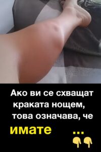 Ако ви се схващат краката нощем, това означава, че имате … 👇👇 2 550543616 813878620985372 7113785977584536898 n