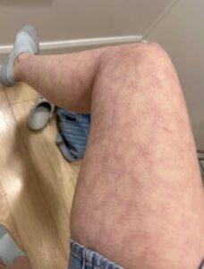 Ето какви са последиците от съня с… Вижте повече 28 565126492 821695453769936 813056