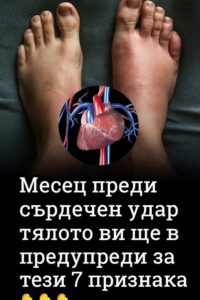 Месец преди сърдечен удар тялото ви ще ви предупреди за тези 7 признака, особено за шестия 😨 👇 62 708918739 1307959621467054 2001557944262773568 n