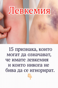 15 признака, които могат да означават, че имате левкемия и които никога не бива да се игнорират. 2 chatgpt image 31.07.2025 g. 17 01 21
