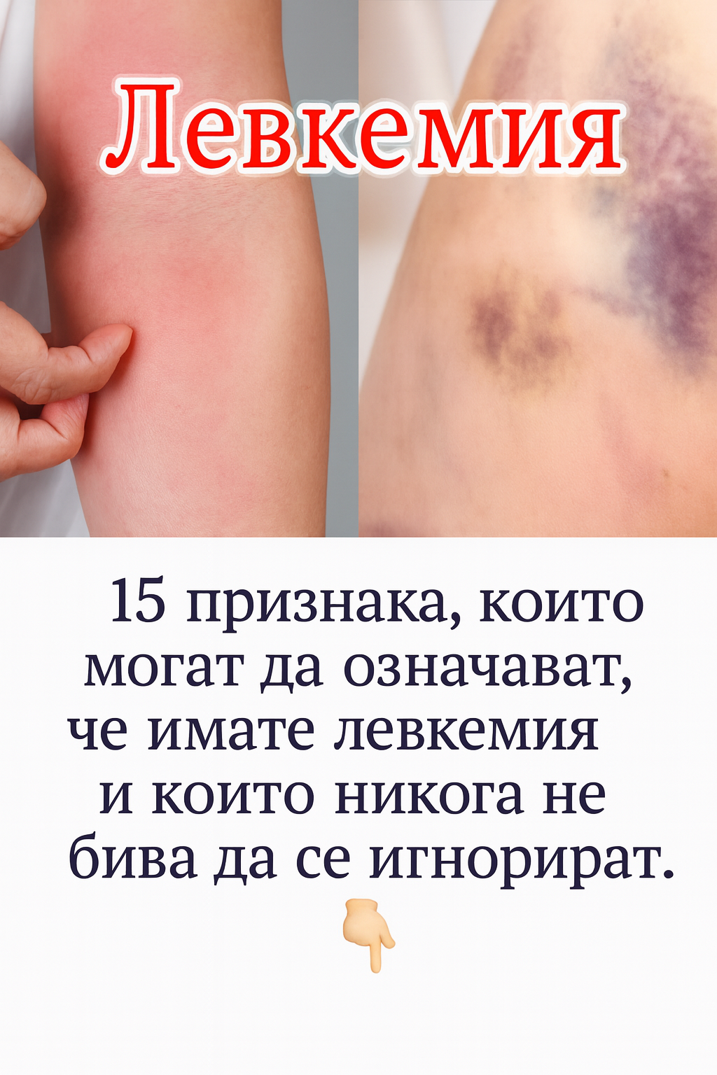 15 признака, които могат да означават, че имате левкемия и които никога не бива да се игнорират. 3 chatgpt image 31.07.2025 g. 17 01 21