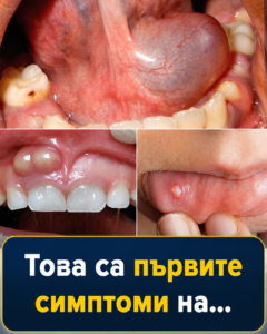 Това са първите симптоми на… 😳 Вижте повече 👇 8 chatgpt image 8.05.2026 g. 11 14 28