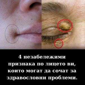 Като следите тези показатели, можете да разпознаете възможни заболявания още при най-ранните им прояви 82 edited health face signs bg 1080 v3