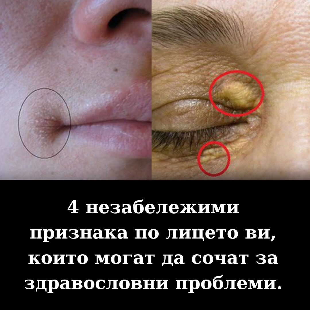 edited health face signs bg 1080 v3