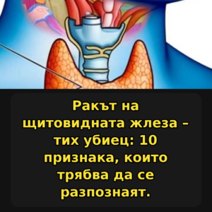 Ракът на щитовидната жлеза – тих убиец: 10 признака, които трябва да бъдат открити… 76 thyroid cancer signs bg 1080x1080 v2