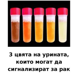 3 цвята на урината, които сигнализират за рак 👇 64 urine colors cancer bg 1080
