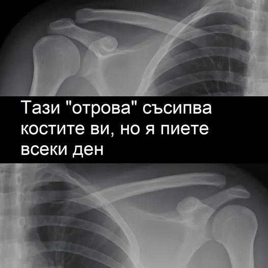 Тази „отрова“ вреди на костите ви – а вие я пиете всеки ден! 3 495339976 1354778712878442 8364893286095807591 n.jpg