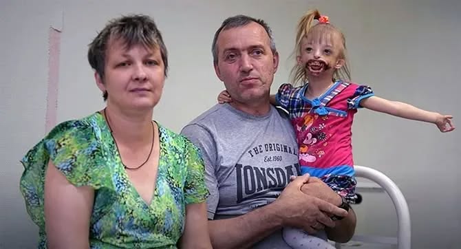 Родена е без челюст и уста, роднините се отказали от нея, защото не можели да я гледат, а това е тя днес: Всички са изумени от промяната и уменията на лекарите-Снимки в пъривя коментар 3 710781901 1465097728754355 1349238026335601789 n