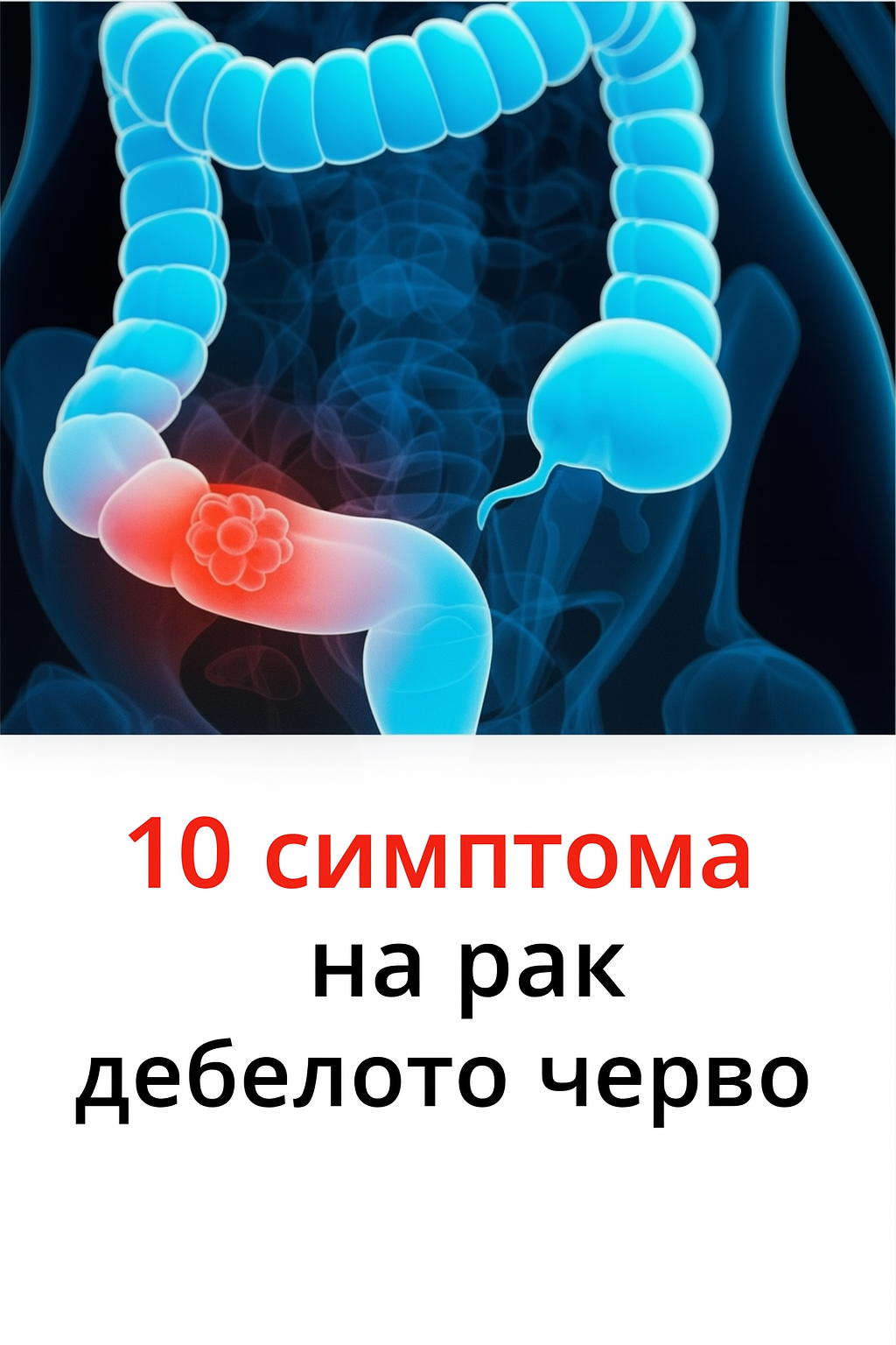 10 признака на рак на червата 3 chatgpt image 10.07.2025 g. 12 57 14