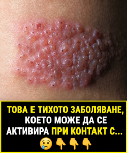 Това е заболяването, което се активира, когато имунната система отслабне... Прочетете повече 👇👇👇 20 chatgpt image 17.06.2026 g. 13 44 42