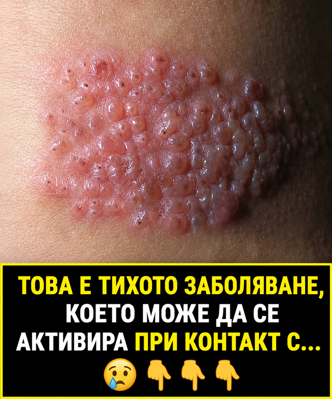 Това е заболяването, което се активира, когато имунната система отслабне... Прочетете повече 👇👇👇 3 chatgpt image 17.06.2026 g. 13 44 42