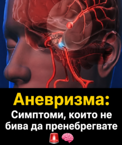 Аневризма: Признаци, които не бива да пренебрегвате... Вижте повече 👇👇 22 chatgpt image 19.06.2026 g. 21 09 48