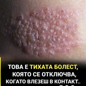 Това е тихата болест, която се отключва, когато влезеш в контакт с …😢👇👇 14 2ba09c79 1d46 438a a348 fcff3ece2816.png