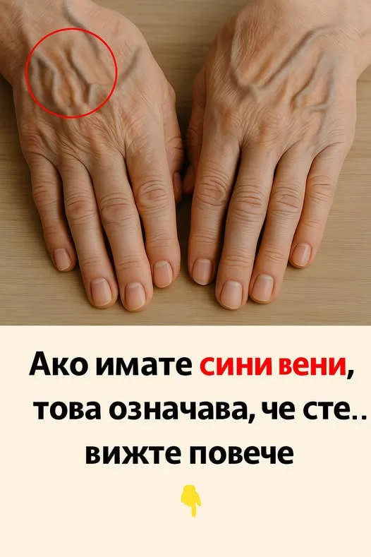 Ако имате сини вени, това означава, че сте… вижте повече 👇 3 515261633 750067814033120 3043774878736462830 n.jpg