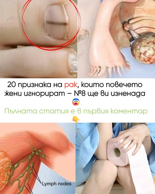 20 признака на рак, които повечето жени игнорират – №8 ще ви изненада 😨 3 516591013 757929426580292 8894731991084366755 n