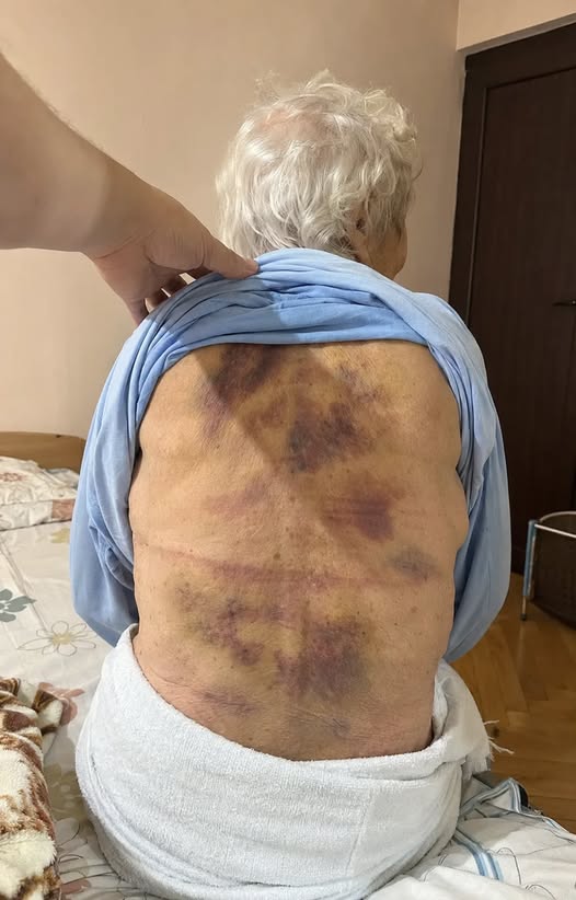 Върнах се у дома, за да помогна на възрастната ми майка да се изкъпе. Щом посегнах да я докосна, тя се сгърчи, сякаш щях да ѝ причиня болка. 3 759479813 1539236294911242 670947399168409503 n