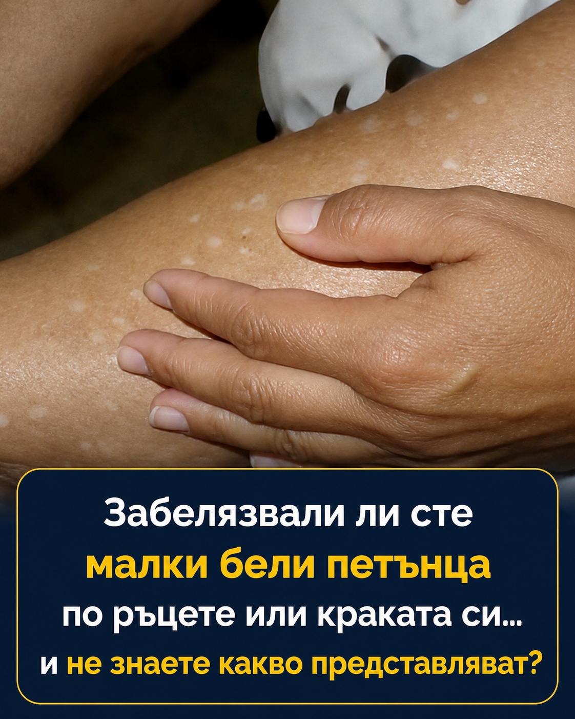 ⚠️ Ако имате бели петна по кожата си, това означава, че сте... 👇 3 chatgpt image 14.07.2026 g. 09 00 21